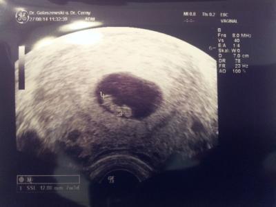 Bild zu Auch zurück vom FA :-) - Forum für April - Mamis