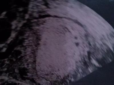 Bild zu Zwillinge??? - Bin so aufgeregt! - Forum für April - Mamis