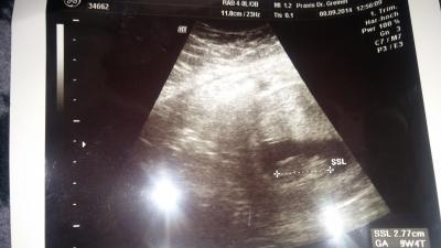 Bild zu fertig beim fa - Forum für April - Mamis