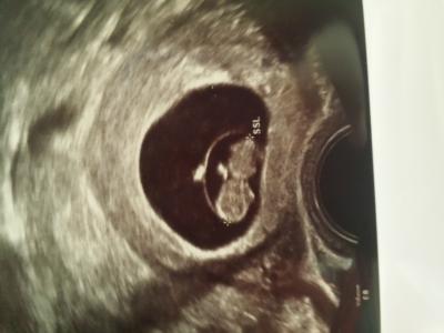 Bild zu @nola und alle anderen :) - Forum für April - Mamis