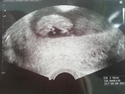 Bild zu Fa Besuch - Forum für April - Mamis