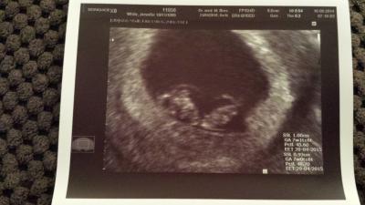 Bild zu Was für ein FA Besuch!! - Forum für April - Mamis