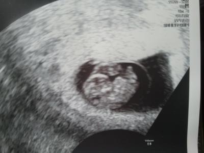 Bild zu Hallo Ssw 9 - Forum für April - Mamis