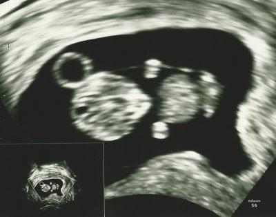 Bild zu US-Bild nachreichen :-) - Forum für April - Mamis