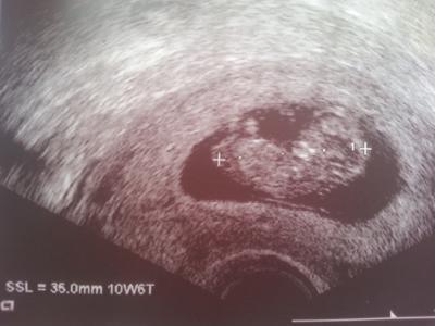 Bild zu Wunderschöner FA-Termin :) - Forum für April - Mamis