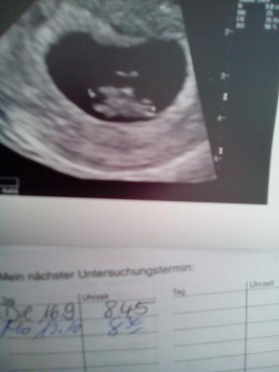 Bild zu Heute FA-Termin gehabt? - Forum für April - Mamis