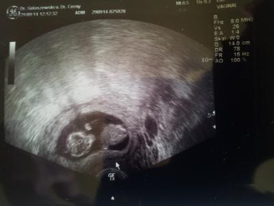 Bild zu Guten Morgen ! Montag war FA Termin - Forum für April - Mamis