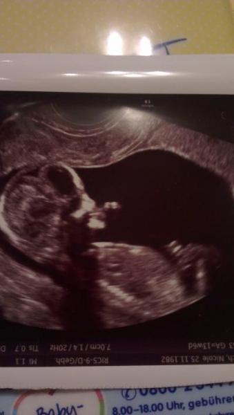 Bild zu Auch mal wieder melden mit FA Bericht :-) - Forum für April - Mamis