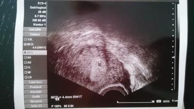 Bild zu 1tes Bild - Forum für April - Mamis
