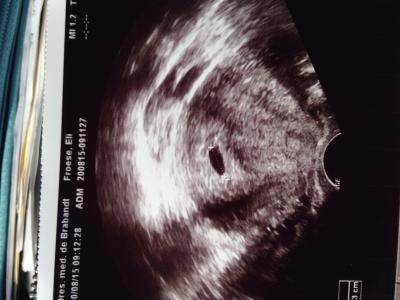 Bild zu Erster Arztbesuch - Forum für April - Mamis