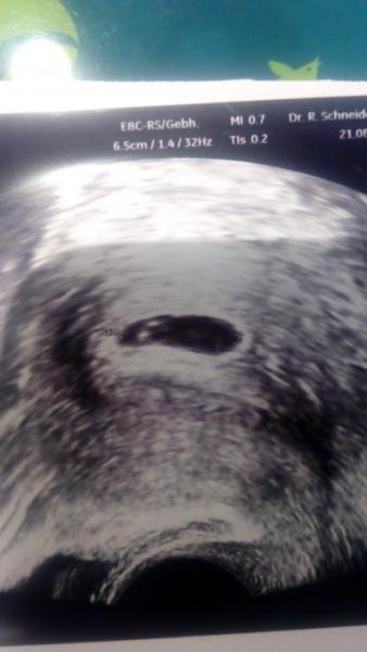 Bild zu Ein Baby oder 2? - Forum für April - Mamis