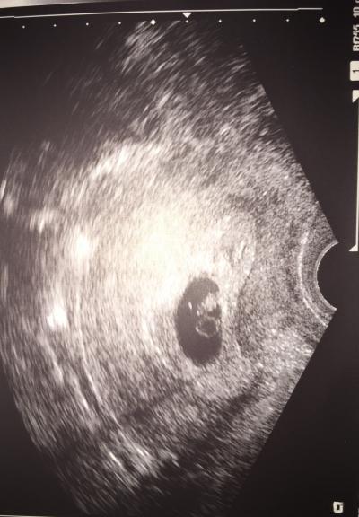 Bild zu Nachtrag mit Bild vom FA-Termin ;) - Forum für April - Mamis