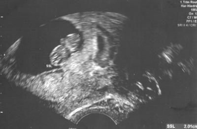 Bild zu Endlich ein bißchen Sicherheit - Forum für April - Mamis