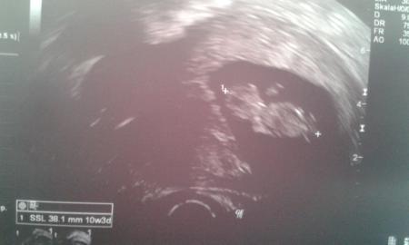 Bild zu FA Bericht - Forum für April - Mamis