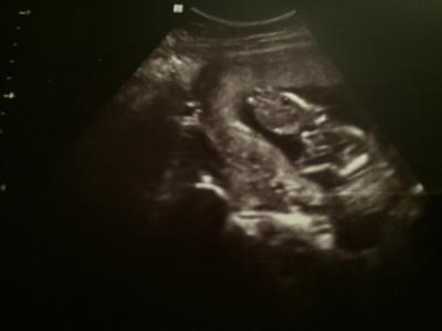 Bild zu Komisches US Bild 14 SSW - Forum für April - Mamis