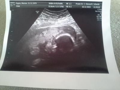Bild zu Ultraschallbild - Forum für April - Mamis