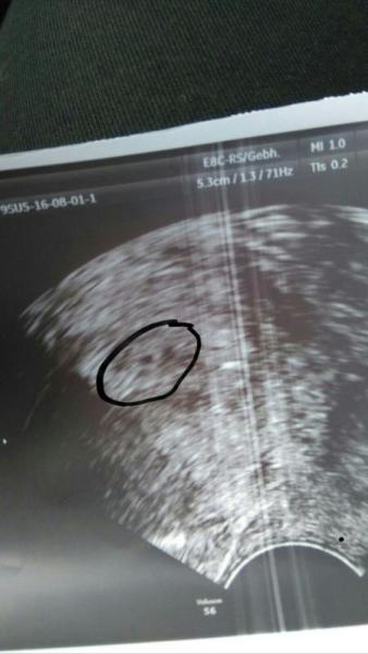 Bild zu 1. US foto - Forum für April - Mamis