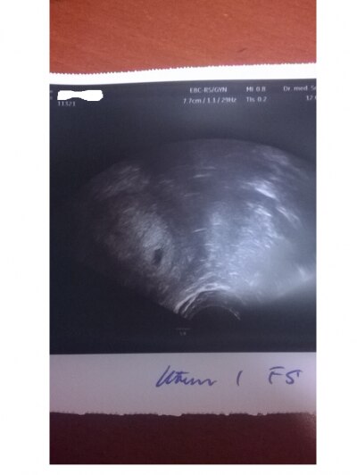 Bild zu Vom Gyn zürück ! - Forum für April - Mamis