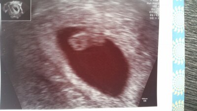 Bild zu Doch noch ein Bild - Forum für April - Mamis