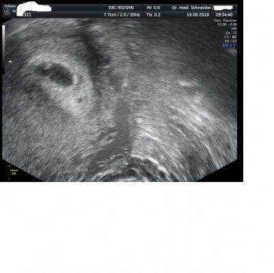 Bild zu Wieder da vom Gyn .... - Forum für April - Mamis