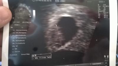 Bild zu kann mal einer mitrechnen bitte ?!! - Forum für April - Mamis