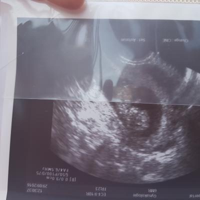 Bild zu Ich habe mein Baby gesehen - Forum für April - Mamis
