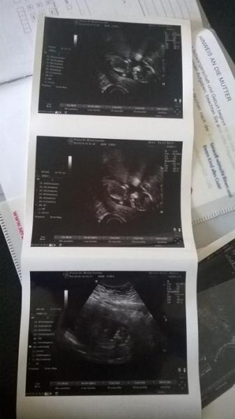 Bild zu Jetzt heisst es CHILLEN und Kinderzimmer fertig machen < 3 - Forum für April - Mamis