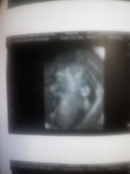 Bild zu 4D bilder - Forum für April - Mamis