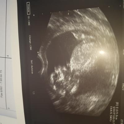 Bild zu Wieder da - Forum für April - Mamis