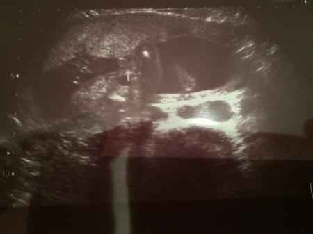Bild zu Geschlecht? - Forum für April - Mamis