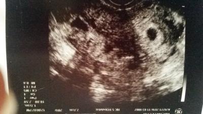 Bild zu Bericht - Forum für April - Mamis