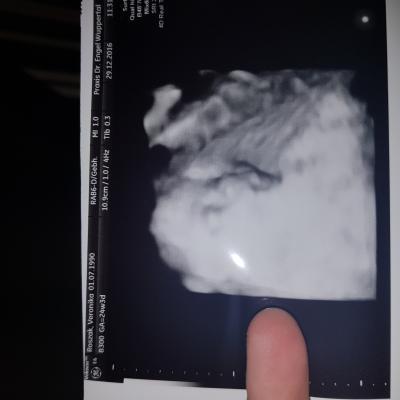 Bild zu Ich war beim 3d - Forum für April - Mamis