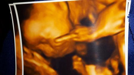 Bild zu War heute beim Ultraschall und der kleine Mann - Forum für April - Mamis