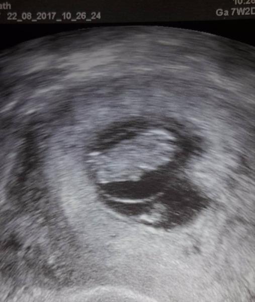 Bild zu Heute ersten FÄ Termin gehabt - Forum für April - Mamis