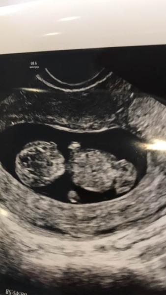 Bild zu Baby TV :) - Forum für April - Mamis