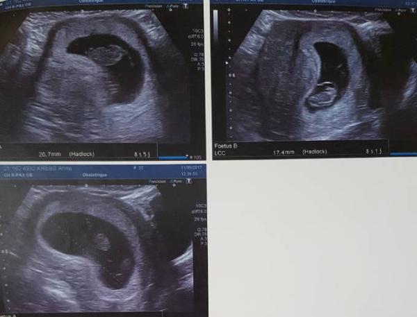 Bild zu Dringend Hilfe - Forum für April - Mamis