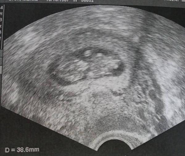 Bild zu Habe endlich Gewissheit - Forum für April - Mamis
