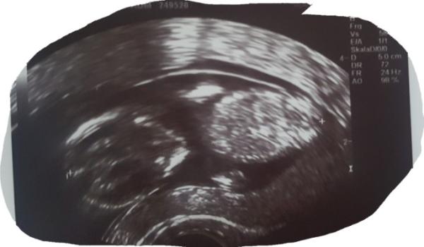 Bild zu Zurueck vom FA - Forum für April - Mamis