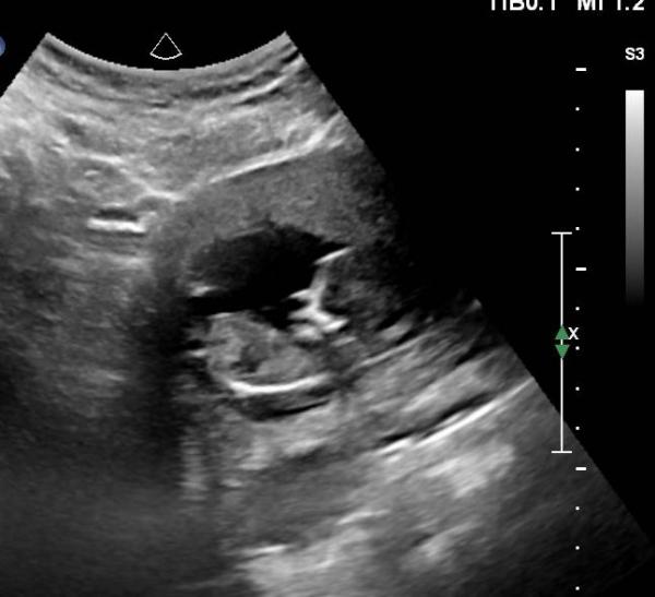 Bild zu VU gehabt.... - Forum für April - Mamis