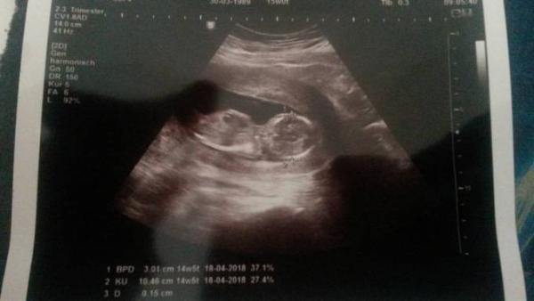 Bild zu Endlich wieder zurück vom FA.... - Forum für April - Mamis
