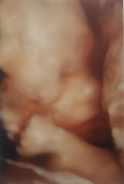 Bild zu Gestern Pränataldiagnostik - Forum für April - Mamis