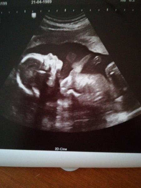 Bild zu Wir verstärken.. - Forum für April - Mamis