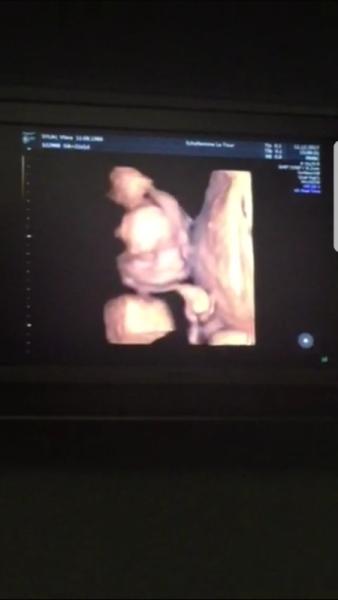 Bild zu 2. Grosser US - Forum für April - Mamis