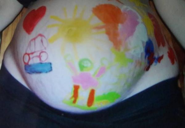 Bild zu