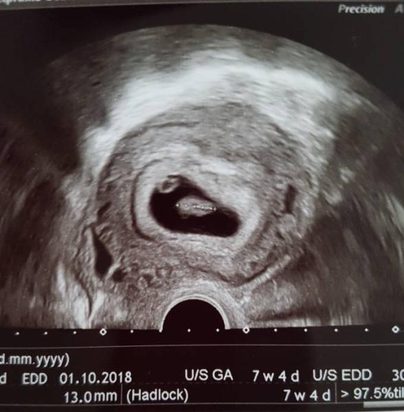 Bild zu Guten Morgen ihr Lieben. - Forum für April - Mamis