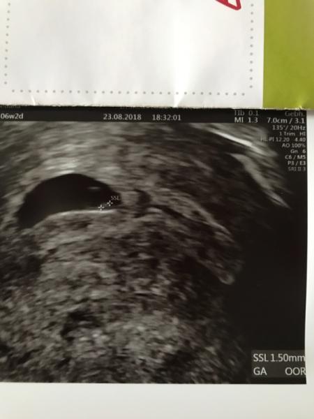 Bild zu Ssw 6+2 - Forum für April - Mamis