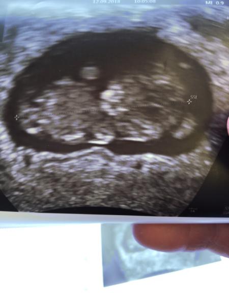 Bild zu Baby geht es gut :)) - Forum für April - Mamis