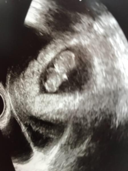 Bild zu Der Gyn Termin war super - Forum für April - Mamis