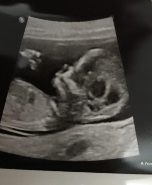 Bild zu ... und die ersten Fotos auf denen man was erkennt - Forum für April - Mamis