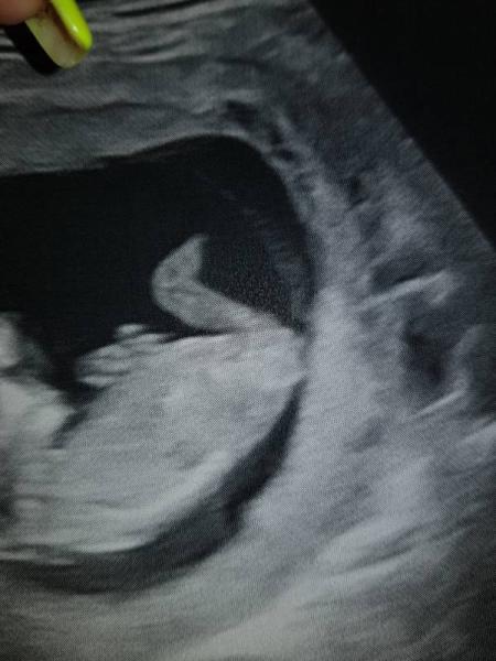 Bild zu Mädchen oder Junge - Forum für April - Mamis